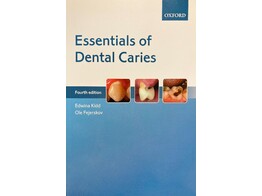 Essentials of Dental Caries 4de editie