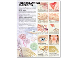 Understanding Allergies Chart Laminated - C