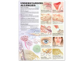 Understanding Allergies Chart Laminated - C
